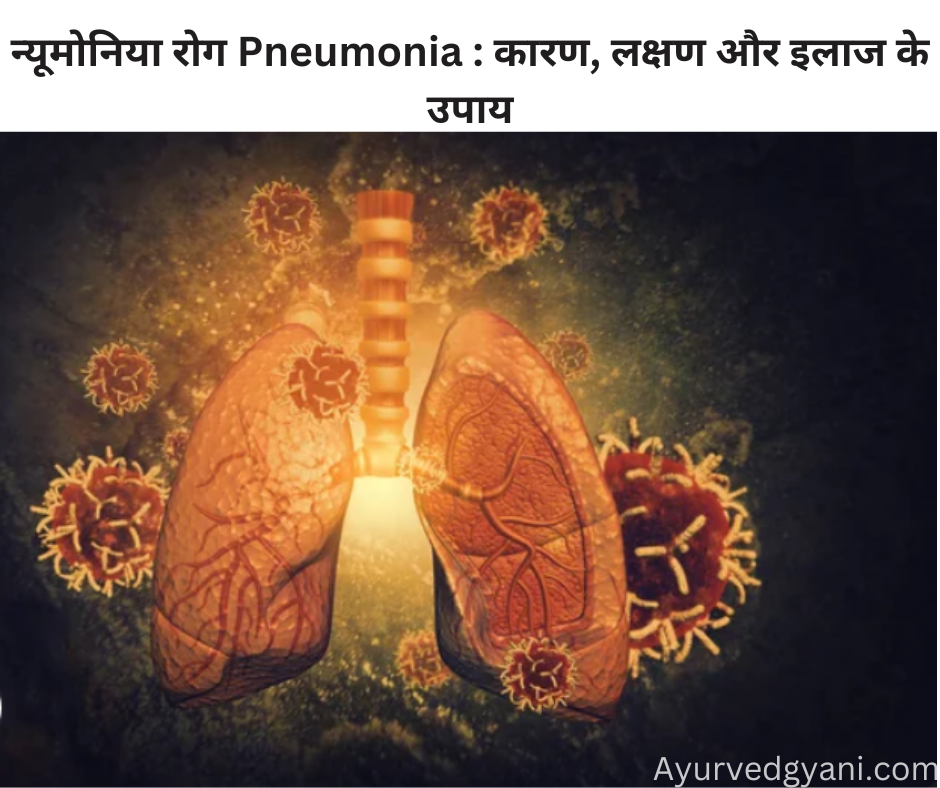 न्यूमोनिया रोग Pneumonia  कारण, लक्षण और इलाज के सर्वोत्तम 4 उपाय