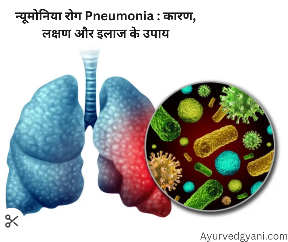 न्यूमोनिया रोग Pneumonia  कारण, लक्षण और इलाज के सर्वोत्तम 4 उपाय