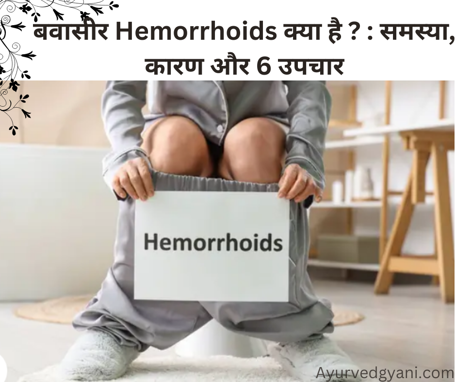 बवासीर Hemorrhoids क्या है ?   : समस्या, कारण और 6 उपचार