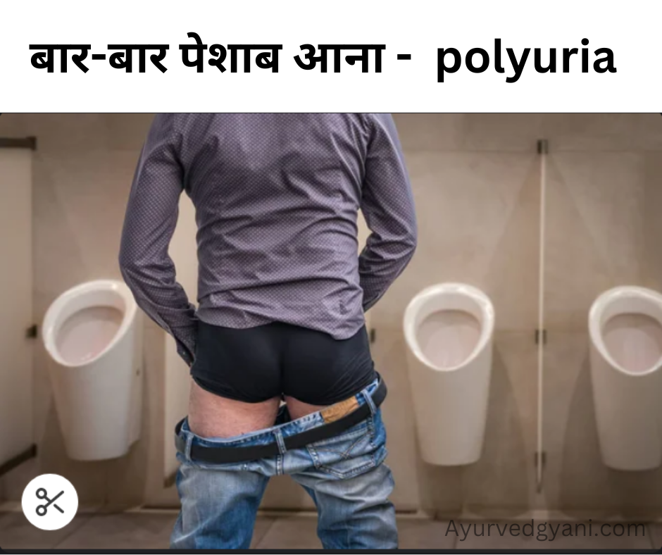 बार-बार पेशाब आना - बहुमूत्र polyuria