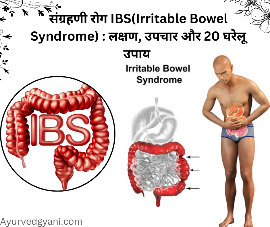 संग्रहणी रोग IBS(Irritable Bowel Syndrome) लक्षण, उपचार और 20 घरेलू उपाय