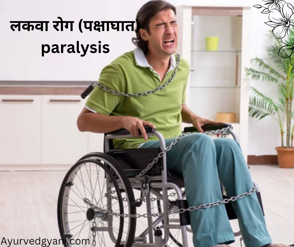 लकवा रोग  (पक्षाघात)paralysis