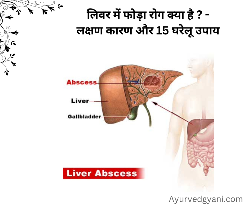 लिवर में फोड़ा liver abscess रोग क्या है ? - लक्षण कारण और 15 घरेलू उपाय