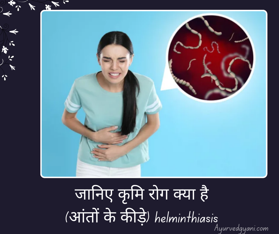 कृमि रोग क्या है (आंतों के कीड़े) helminthiasis - जानिए लक्षण, कारण, और 4  तरह के उपाय