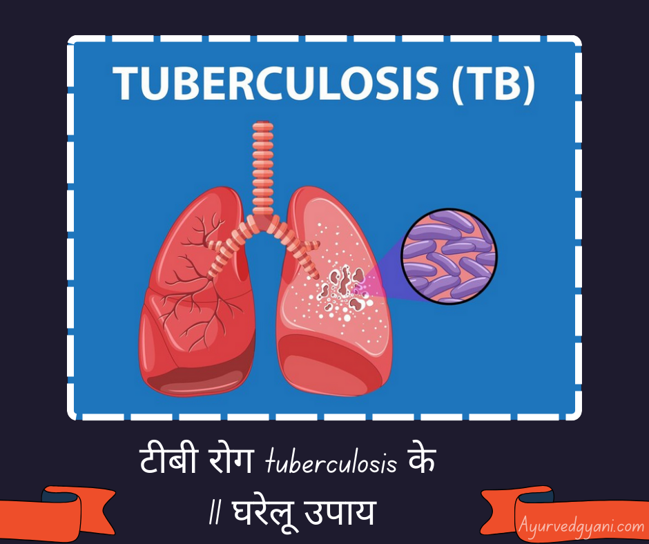 टीबी रोग tuberculosis के 
11 घरेलू उपाय