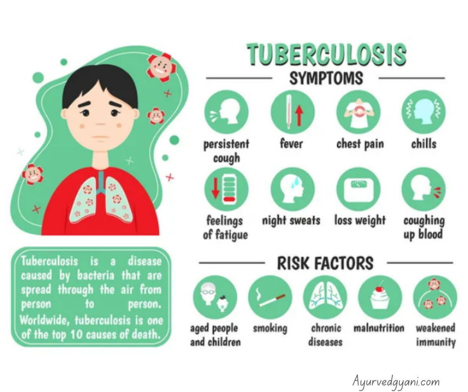 टीबी रोग tuberculosis के 
11 घरेलू उपाय